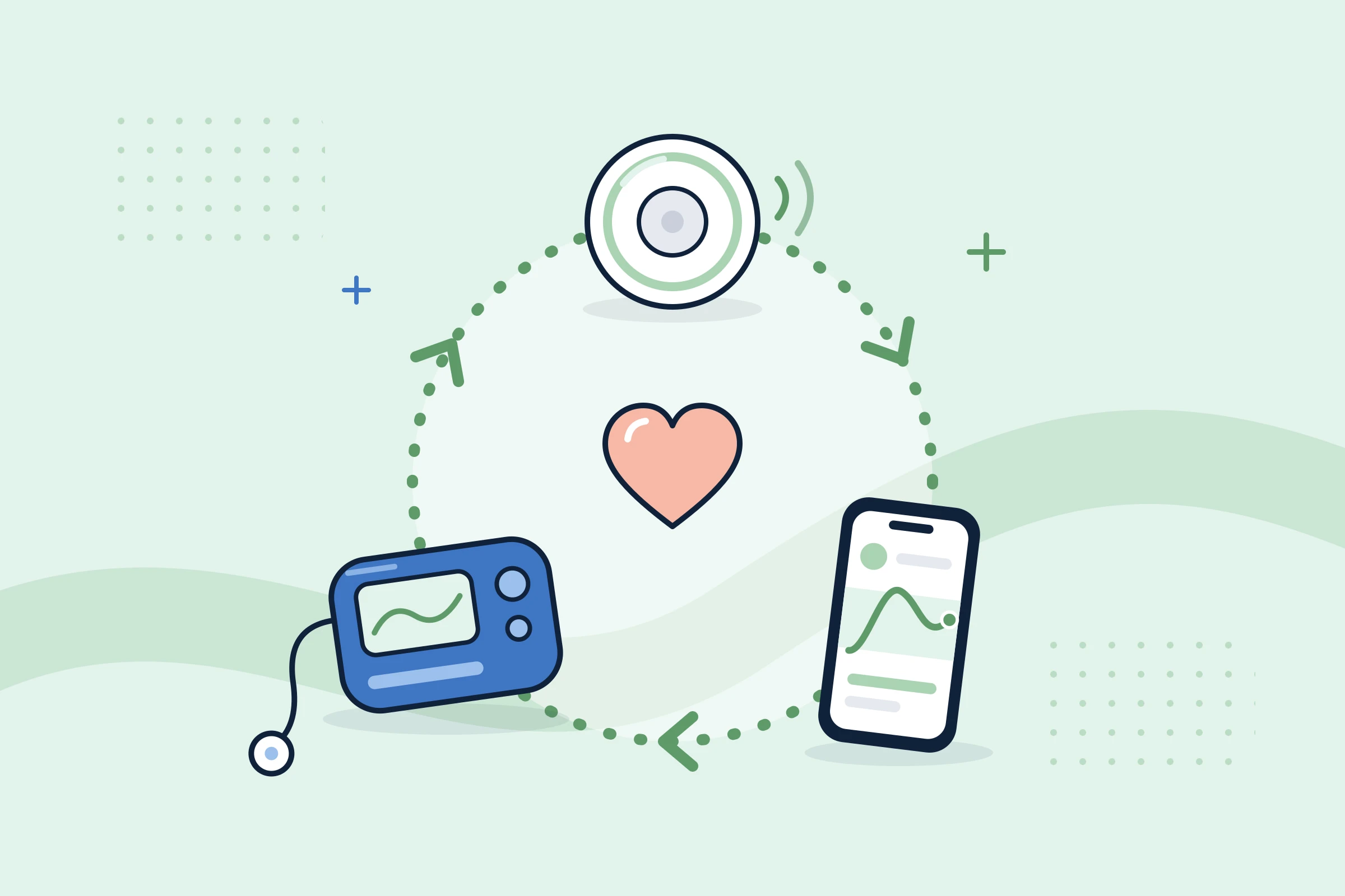 Illustration : capteur, pompe à insuline et smartphone reliés par une boucle